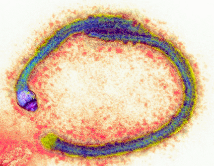 Image: Colored transmission electron micrograph (TEM) of Ebola virus particles (Photo courtesy of Hazel Appleton, Center for Infections / Health Protection Agency).